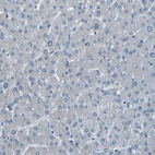 Immunohistochemical staining of human liver shows no positivity in hepatocytes as expected.