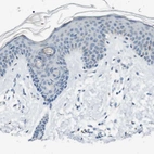 Immunohistochemical staining of human skin shows low expression as expected.