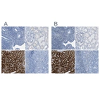 Immunohistochemical staining of human endometrium, kidney, liver and tonsil using Anti-ASGR1 antibody HPA012852 (A) shows similar protein distribution across tissues to independent antibody HPA011954 (B).