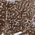 Immunohistochemical staining of human liver shows strong cytoplasmic positivity in hepatocytes.