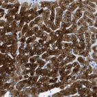 Immunohistochemical staining of human liver shows strong cytoplasmic positivity in hepatocytes.