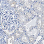 Immunohistochemical staining of human kidney shows no positivity in cells in tubules as expected.