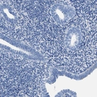 Immunohistochemical staining of human endometrium shows no positivity in glandular cells as expected.