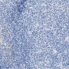 Immunohistochemical staining of human tonsil shows no positivity in germinal center cells as expected.