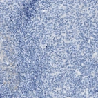Immunohistochemical staining of human tonsil shows no positivity in germinal center cells as expected.