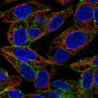 Immunofluorescent staining of human cell line Hep G2 shows localization to cell junctions & vesicles.