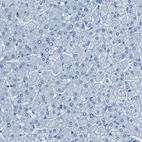 Immunohistochemical staining of human liver shows no positivity in hepatocytes as expected.