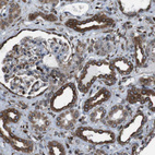 Immunohistochemical staining of human kidney shows strong cytoplasmic positivity in cells in distal tubules.
