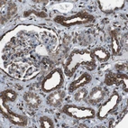 Immunohistochemical staining of human kidney shows strong cytoplasmic positivity in cells in distal tubules.