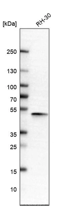 Western blot analysis in human cell line RH-30.