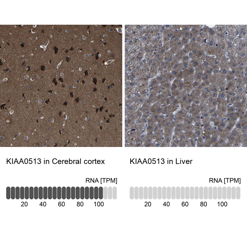 Anti-KIAA0513 Antibody