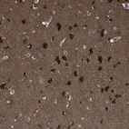 Immunohistochemical staining of human cerebral cortex shows high expression.