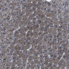 Immunohistochemical staining of human liver shows low expression as expected.