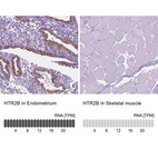 Anti-HTR2B Antibody