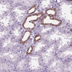 Immunohistochemical staining of human kidney shows moderate membranous positivity in cells in tubules.