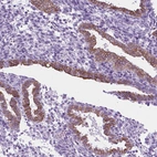 Immunohistochemical staining of human endometrium shows moderate membranous positivity in glandular cells.