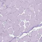 Immunohistochemical staining of human skeletal muscle shows no positivity in myocytes as expected.