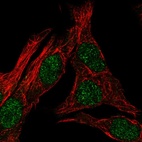Immunofluorescent staining of human cell line SK-MEL-30 shows localization to nucleoplasm.