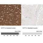 Anti-SYT7 Antibody