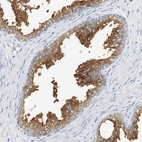 Immunohistochemical staining of human prostate shows moderate to strong cytoplasmic positivity in glandular cells.