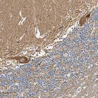 Immunohistochemical staining of human cerebellum shows moderate to strong cytoplasmic positivity in purkinje cells.