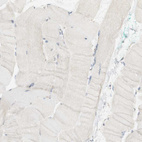 Immunohistochemical staining of human skeletal muscle shows no cytoplasmic positivity in myocytes as expected.