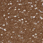 Immunohistochemical staining of human cerebral cortex shows strong positivity in neuropil.