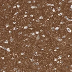 Immunohistochemical staining of human cerebral cortex shows strong positivity in neuropil.