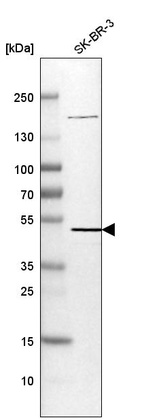 Western blot analysis in human cell line SK-BR-3.
