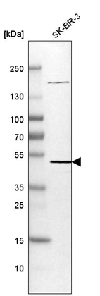 Western blot analysis in human cell line SK-BR-3.