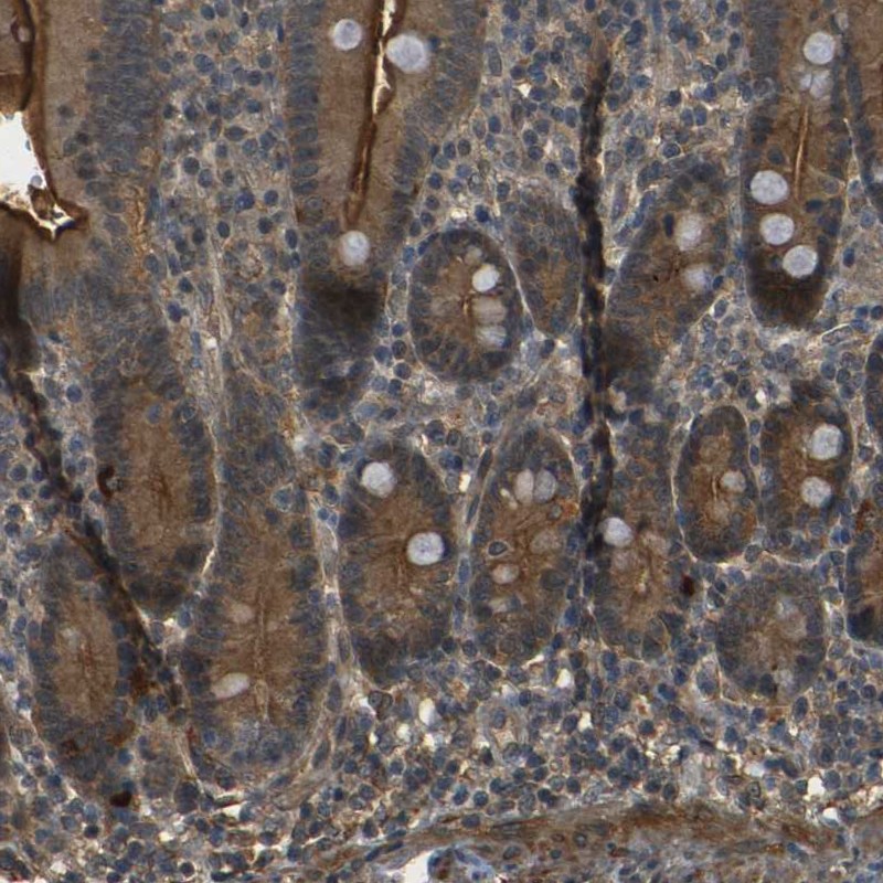 Anti-PDE5A Antibody