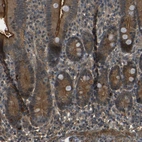 Anti-PDE5A Antibody