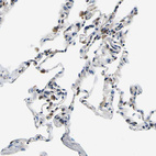 Immunohistochemical staining of human lung shows moderate cytoplasmic positivity in macrophages.