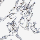 Immunohistochemical staining of human lung shows moderate cytoplasmic positivity in macrophages.