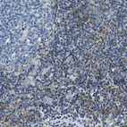 Immunohistochemical staining of human tonsil shows moderate cytoplasmic positivity in non - germinal center cells.
