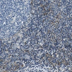 Immunohistochemical staining of human tonsil shows moderate cytoplasmic positivity in non - germinal center cells.