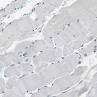 Immunohistochemical staining of human skeletal muscle shows no positivity in myocytes as expected.