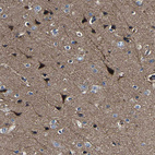 Anti-AGAP3 Antibody