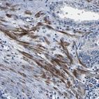 Immunohistochemical staining of human Prostate shows moderate cytoplasmic positivity in smooth muscle cells.