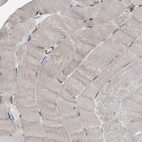 Immunohistochemical staining of human Skeletal muscle shows moderate cytoplasmic positivity in myocytes.