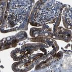 Immunohistochemical staining of human Duodenum shows moderate cytoplasmic positivity in glandular cells.