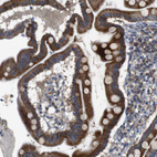 Immunohistochemical staining of human duodenum shows strong granular cytoplasmic positivity in glandular cells.