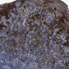 Immunohistochemical staining of human tonsil shows strong granular cytoplasmic positivity in squamous epithelial cells.
