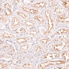 Immunohistochemical staining of human kidney shows strong membranous positivity in cells in tubules.