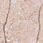 Immunohistochemical staining of human pancreas shows strong membranous and cytoplasmic positivity in exocrine glandular cells.