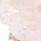 Immunohistochemical staining of human skeletal muscle shows very weak positivity in myocytes.