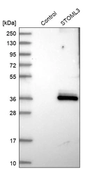 Anti-STOML3 Antibody