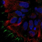 Immunofluorescent staining of human cell line AF22 shows localization to plasma membrane.