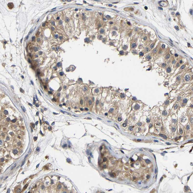 Anti-LRRCC1 Antibody