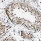Anti-LRRCC1 Antibody